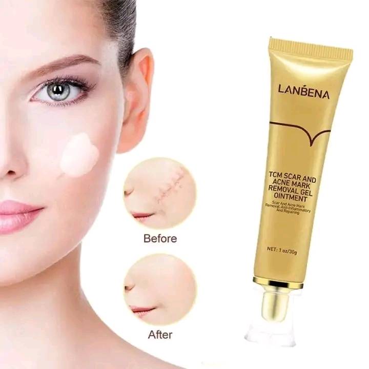 Lanbena TCM Scar And Acne Mark Removal Cream